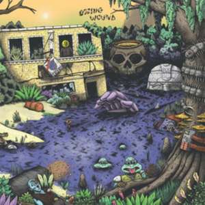 High Anxiety de Oozing Wound