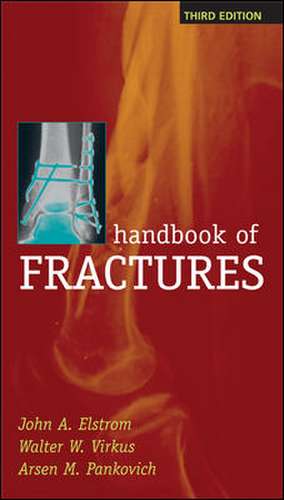 Handbook of Fractures, Third Edition de John Elstrom