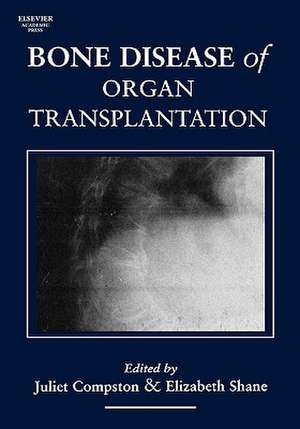 Bone Disease of Organ Transplantation de Juliet Compston