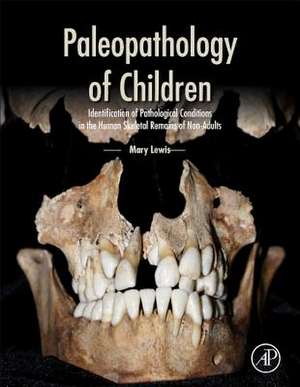 Paleopathology of Children: Identification of Pathological Conditions in the Human Skeletal Remains of Non-Adults de Mary Lewis