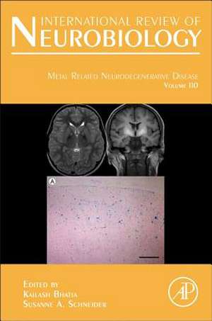 Metal Related Neurodegenerative Disease de Kailash P Bhatia