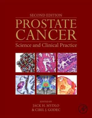 Prostate Cancer: Science and Clinical Practice de Jack H. Mydlo