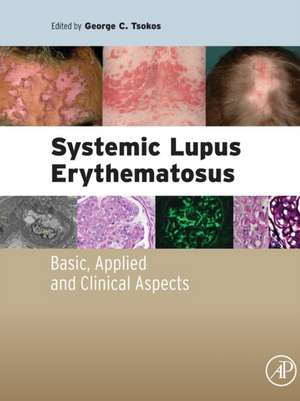 Systemic Lupus Erythematosus: Basic, Applied and Clinical Aspects de George C. Tsokos