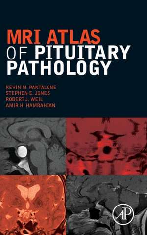 MRI Atlas of Pituitary Pathology de Kevin M. Pantalone