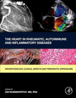 The Heart in Rheumatic, Autoimmune and Inflammatory Diseases: Pathophysiology, Clinical Aspects and Therapeutic Approaches de Udi Nussinovitch