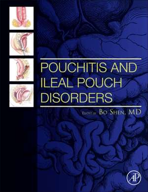 Pouchitis and Ileal Pouch Disorders: A Multidisciplinary Approach for Diagnosis and Management de Bo Shen