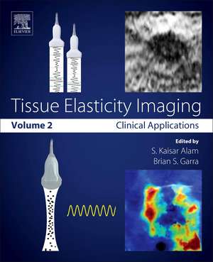 Tissue Elasticity Imaging: Volume 2: Clinical Applications de S. Kaisar Alam