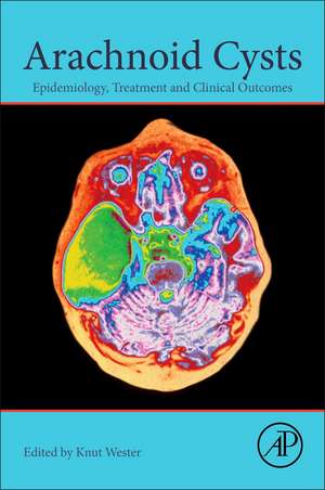 Arachnoid Cysts: Epidemiology, Biology, and Neuroimaging de Knut Wester
