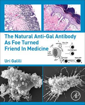 The Natural Anti-Gal Antibody as Foe Turned Friend in Medicine de Uri Galili