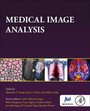 Medical Image Analysis de Alejandro Frangi