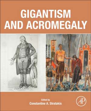 Gigantism and Acromegaly de Constantine A. Stratakis