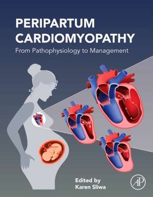 Peripartum Cardiomyopathy: From Pathophysiology to Management de Karen Sliwa