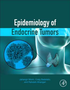 Epidemiology of Endocrine Tumors de Jahangir Moini