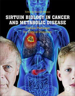 Sirtuin Biology in Cancer and Metabolic Disease: Cellular Pathways for Clinical Discovery de Kenneth Maiese