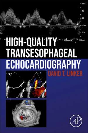 High-Quality Transesophageal Echocardiography de David T. Linker