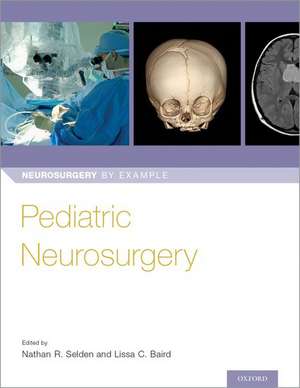 Pediatric Neurosurgery de Nathan Selden