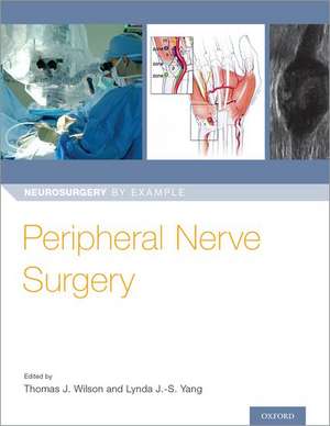 Peripheral Nerve Surgery de Thomas Wilson