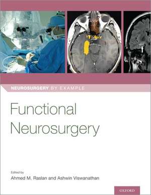 Functional Neurosurgery de Ahmed Raslan