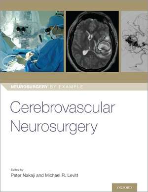 Cerebrovascular Neurosurgery de Peter Nakaji