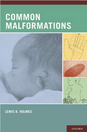 Common Malformations de Lewis B. Holmes