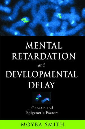 Mental Retardation and Developmental Delay: Genetic and Epigenetic Factors de Moyra Smith