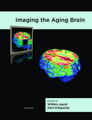 Imaging the Aging Brain de William Jagust