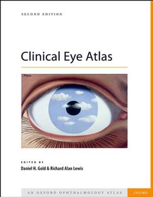 Clinical Eye Atlas de Daniel Gold