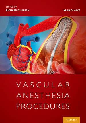 Vascular Anesthesia Procedures de Richard Urman