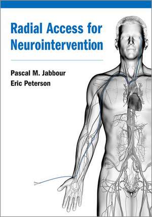 Radial Access for Neurointervention de Pascal Jabbour