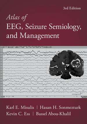 Atlas of EEG, Seizure Semiology, and Management de Bassel Abou-Khalil