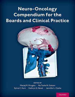 Neuro-Oncology Compendium for the Boards and Clinical Practice de Maciej M. Mrugala