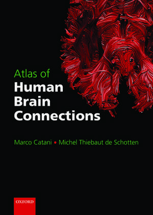 Atlas of Human Brain Connections de Marco Catani