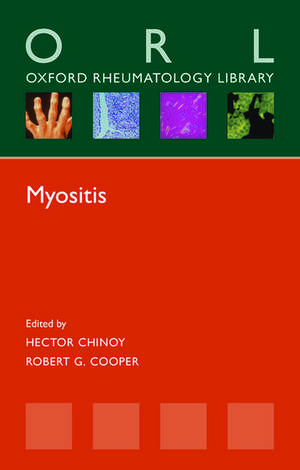 Myositis de Hector Chinoy