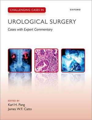 Challenging Cases in Urological Surgery de Karl Pang