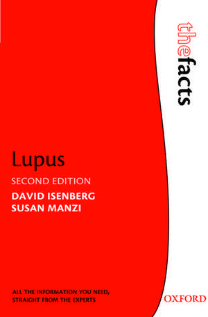 Lupus de David Isenberg