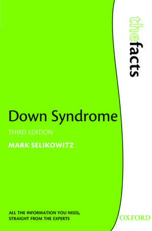 Down Syndrome de Mark Selikowitz