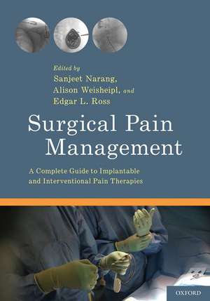 Surgical Pain Management: A Complete Guide to Implantable and Interventional Pain Therapies de Sanjeet Narang