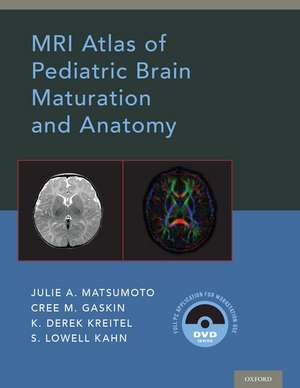 MRI Atlas of Pediatric Brain Maturation and Anatomy de Julie A. Matsumoto