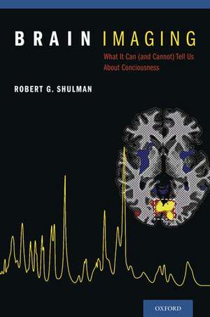 Brain Imaging: What it Can (and Cannot) Tell Us About Consciousness de Robert G. Shulman