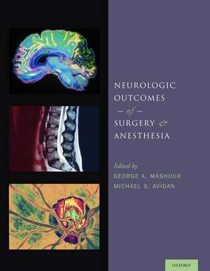 Neurologic Outcomes of Surgery and Anesthesia de George A. Mashour