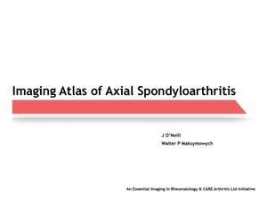 Imaging Atlas of Axial Spondyloarthritis de J. O'Neill