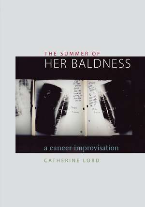 The Summer of Her Baldness: A Cancer Improvisation de Catherine Lord