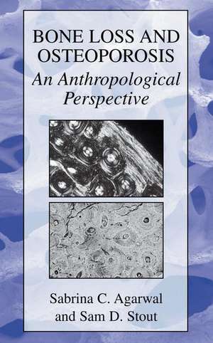 Bone Loss and Osteoporosis: An Anthropological Perspective de Sabrina C. Agarwal