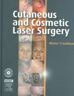 Cutaneous and Cosmetic Laser Surgery: Text with DVD de Mitchel P. Goldman