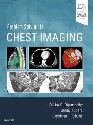 Problem Solving in Chest Imaging de Subba R. Digumarthy