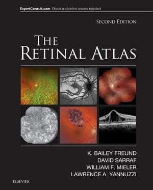 The Retinal Atlas de K. Bailey Freund