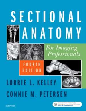 Sectional Anatomy for Imaging Professionals de Lorrie L. Kelley