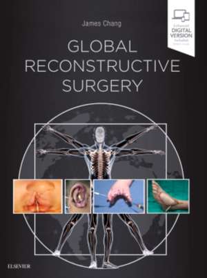 Global Reconstructive Surgery de James Chang