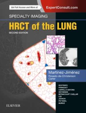 Specialty Imaging: HRCT of the Lung de Santiago Martínez-Jiménez