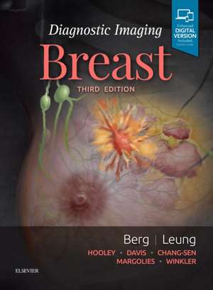 Diagnostic Imaging: Breast de Wendie A. Berg